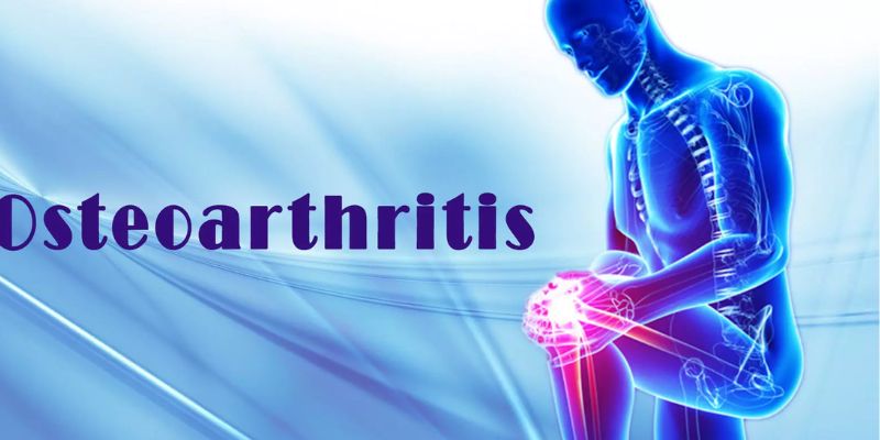 Everything You Need To Know About Osteoarthritis